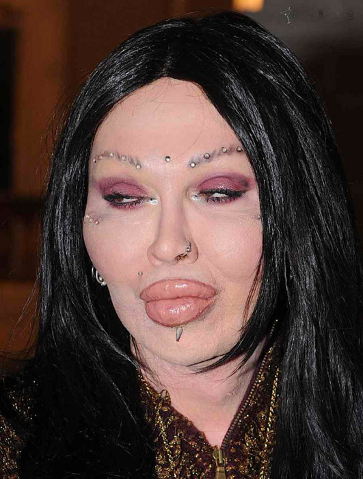 Plastic Surgery Gone Wrong (17 pics)