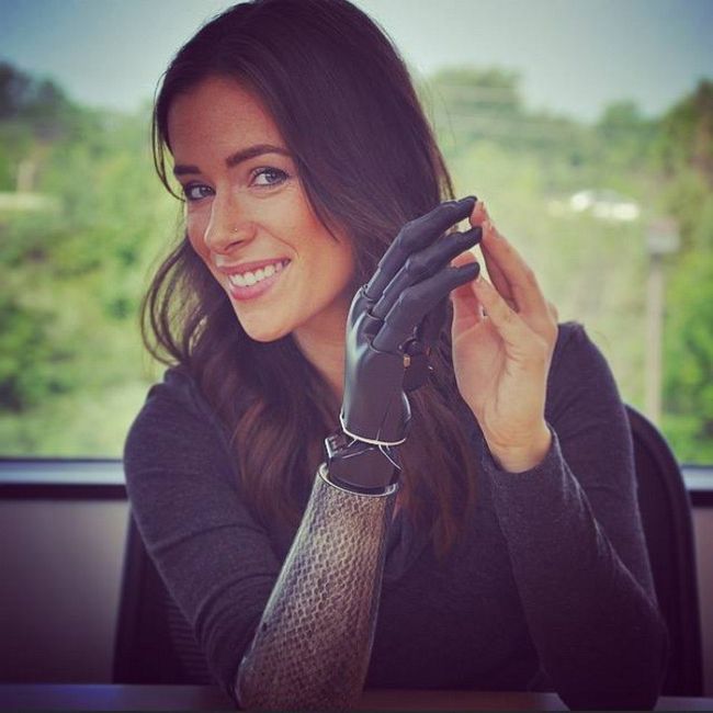 Meet The Beautiful Model With A Bionic Arm (12 pics)