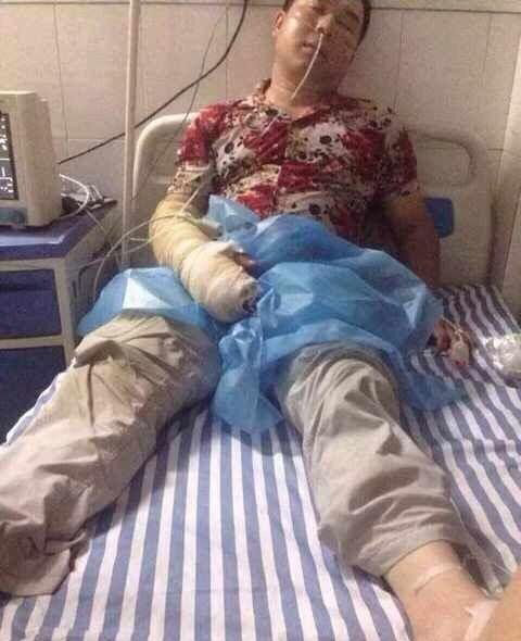 Chinese Man Trying To Get Friendly With A Poisonous Snake Goes Horribly Wrong (3 pics)