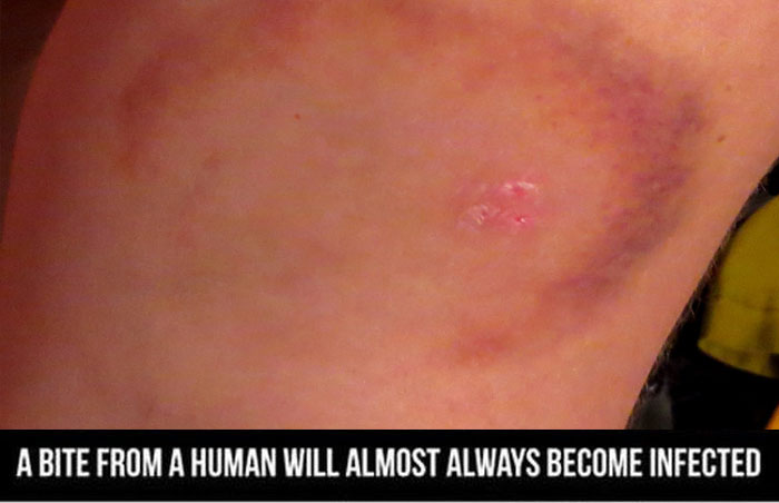 Fun Facts Every Person Should Know About The Human Body (7 pics)