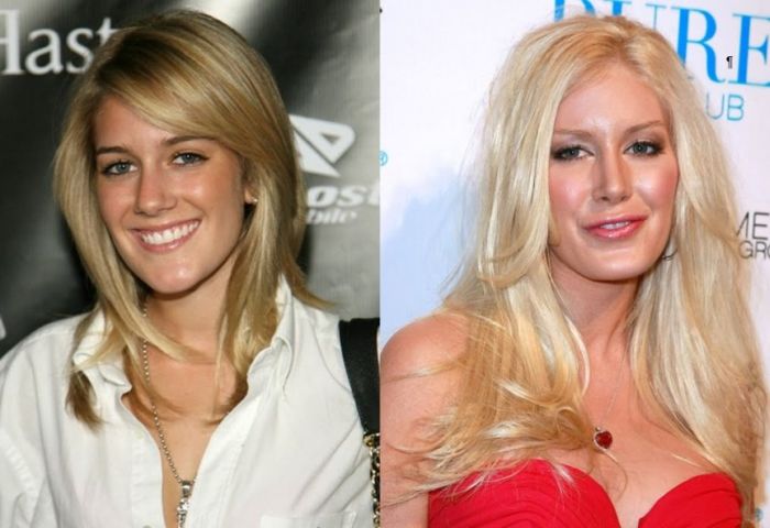 Celebrity Transformations That Surprised The World (13 pics)