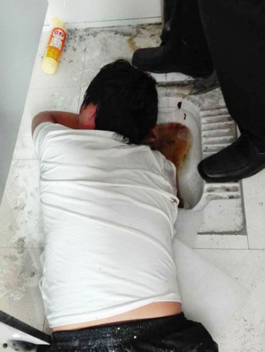 Man Gets His Hand Stuck In The Toilet (4 pics)