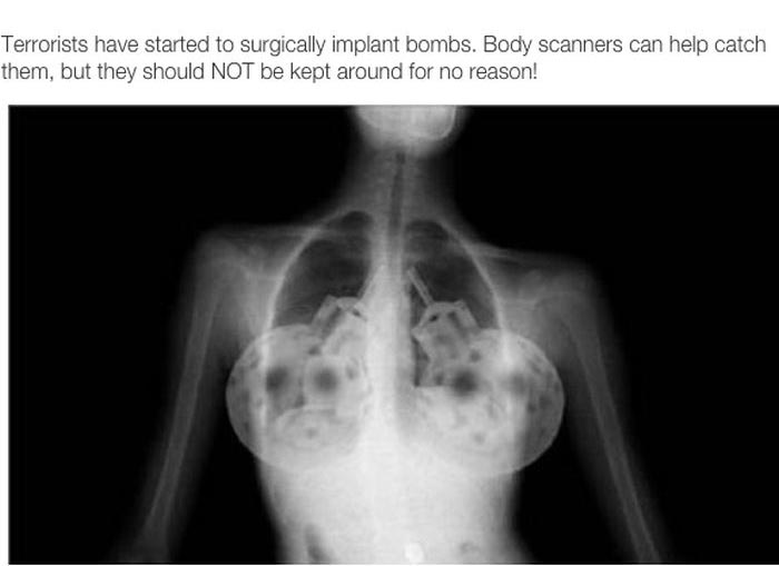 It Turns Out Nothing's Really Private About Full Body Scan Images At The Airport (7 pics)