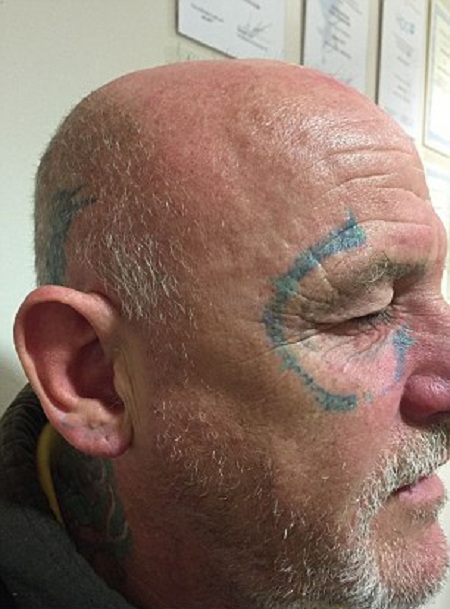 Man Wakes Up With A Pair Of Ray-Ban Sunglasses Tattooed On His Face (5 pics)