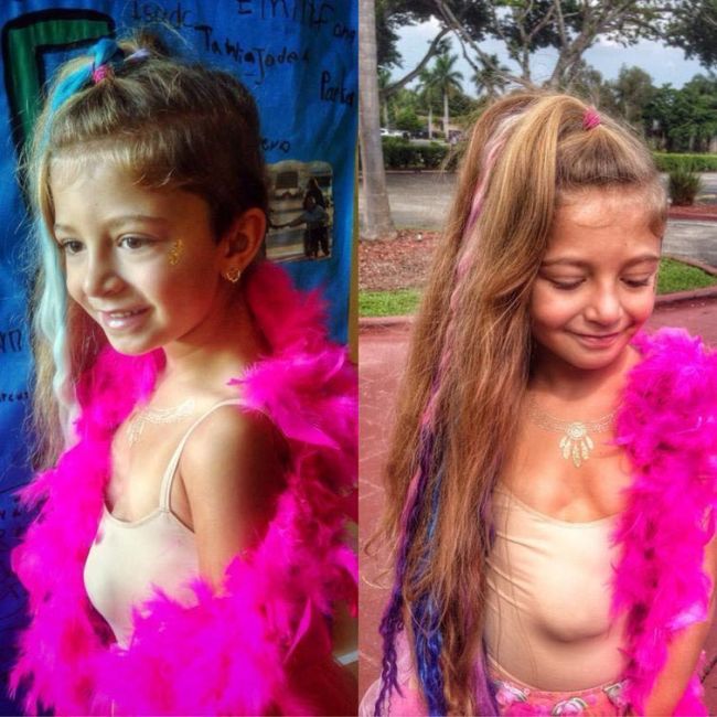 Six Year Old Girl Born With Her Heart Outside Of Her Chest Is Defying The Odds (8 pics)