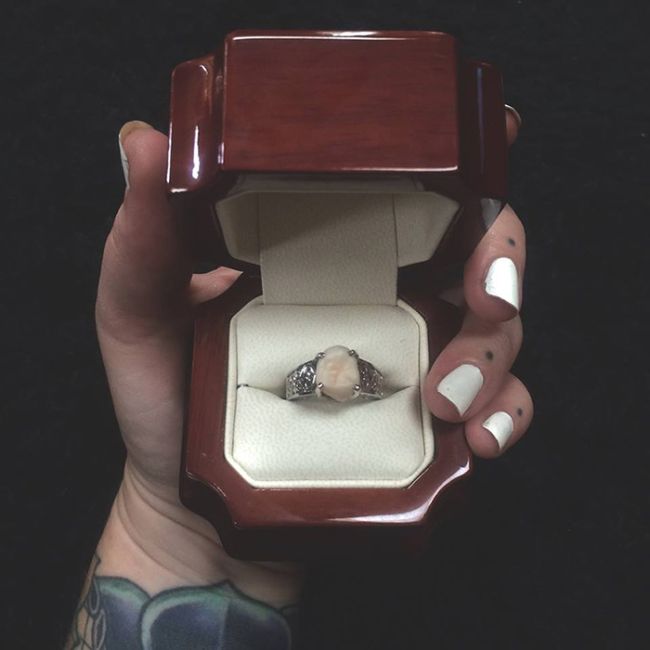 Instead Of A Diamond This Woman Got A Wisdom Tooth In Her Engagement Ring (5 pics)