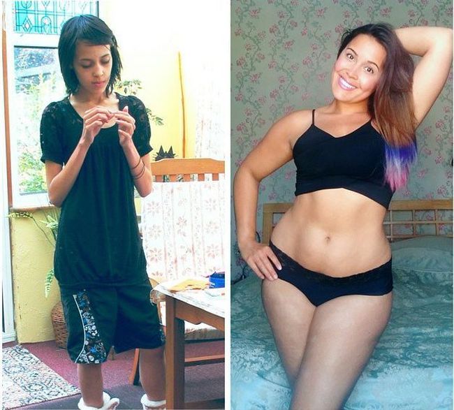 Babe Beats An Eating Disorder To Become A Full Figured Beauty (11 pics)