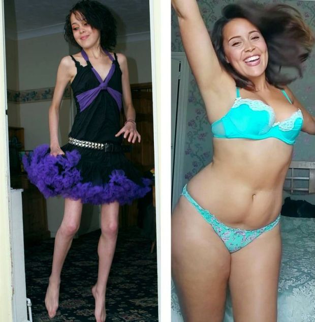 Babe Beats An Eating Disorder To Become A Full Figured Beauty (11 pics)