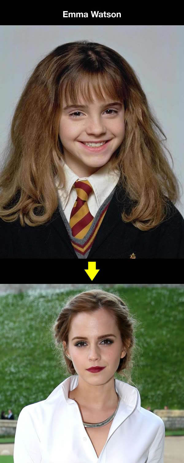 Puberty Did Wonders For These Once Awkward Looking Celebrities (10 pics)