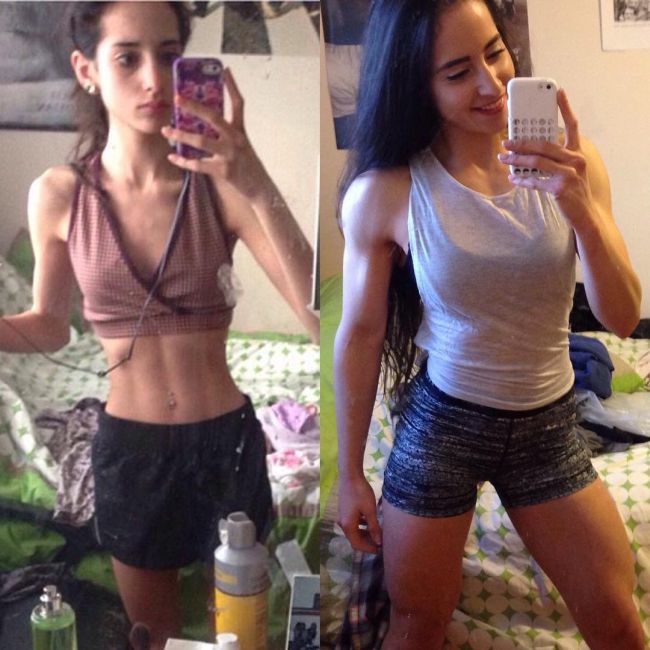Anorexic Girl Changes Her Life And Completely Transforms Her Body (9 pics)