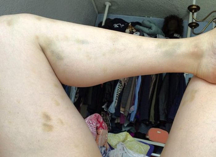 Comedian Posts Graphic Photo And Gets Serious About Abusive Relationships (4 pics)