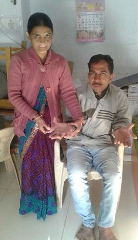 A Man In India Holds The Guinness World Record For Having The Most Fingers (7 pics)