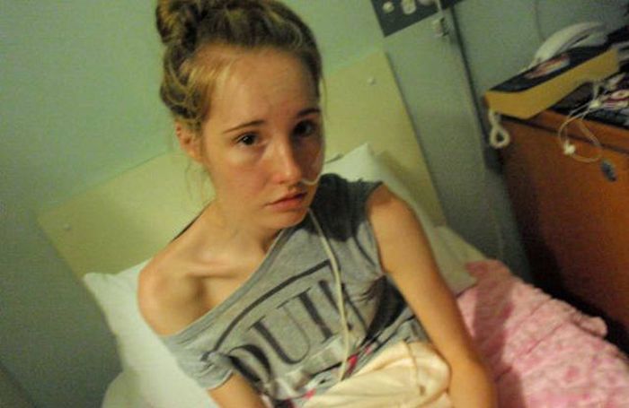 Girl Makes Amazing Recovery After Almost Losing Her Life To Anorexia (16 pics)