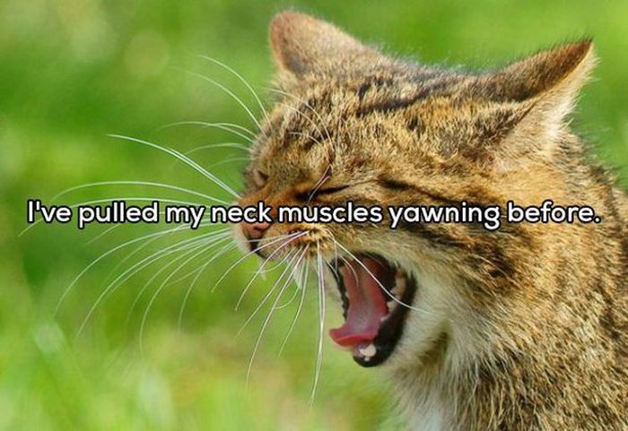 People Reveal The Strangest Ways They've Injured Themselves (20 pics)