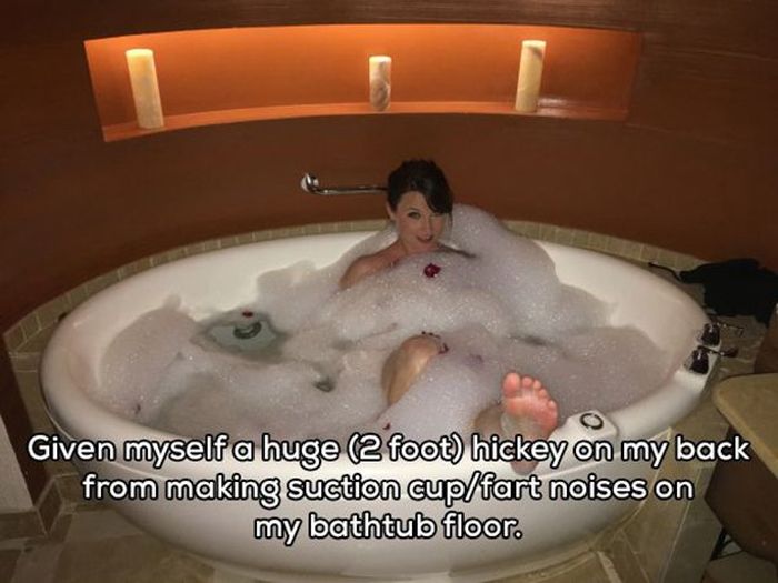 People Reveal The Strangest Ways They've Injured Themselves (20 pics)