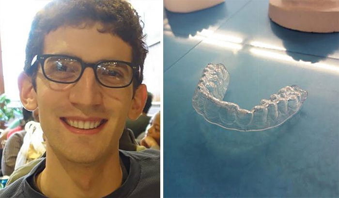 College Student Saves Thousands Of Dollars By 3D Printing His Own Braces (6 pics)