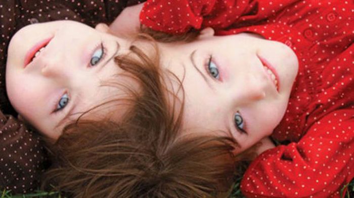 Fascinating Facts About Twins That Might Blow Your Mind (16 pics)