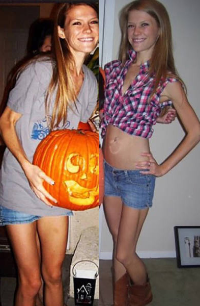 From Anorexic To CrossFit Athlete In 6 Years (24 pics)