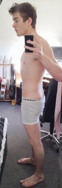 Teen Becomes Bodybuilder After Being Told He Would Never Walk Again (10 pics)