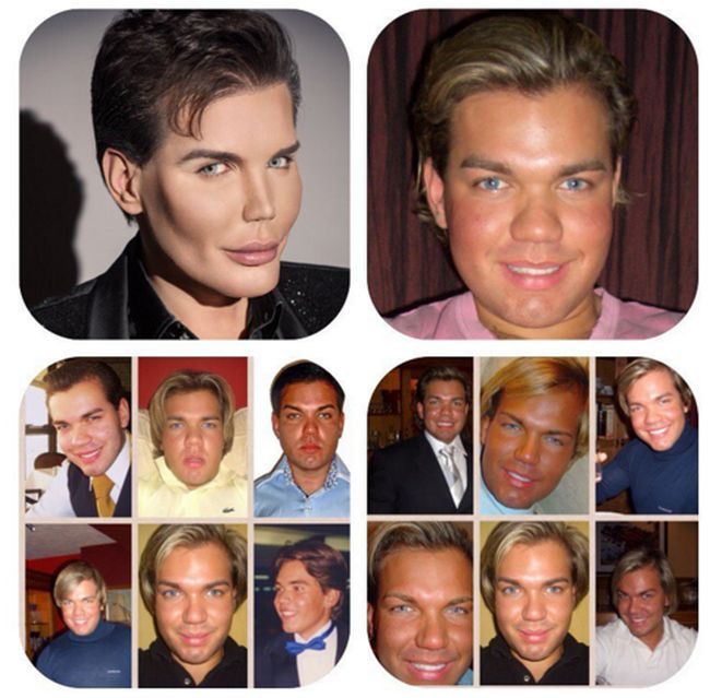 This Guy Really Messed Up His Face While Turning Himself Into A Human Ken Doll (5 pics)