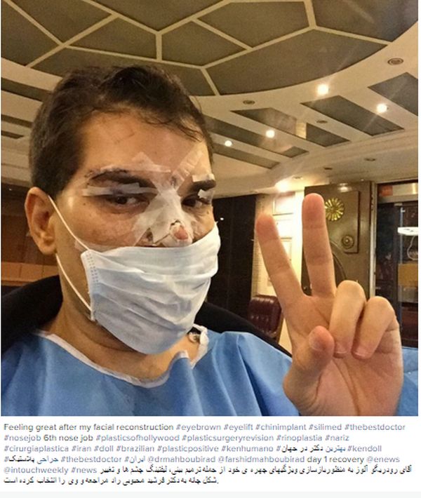 This Guy Really Messed Up His Face While Turning Himself Into A Human Ken Doll (5 pics)