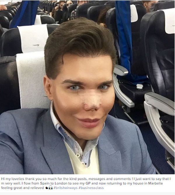 This Guy Really Messed Up His Face While Turning Himself Into A Human Ken Doll (5 pics)