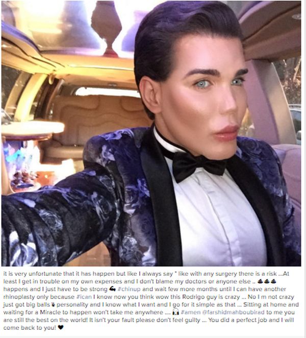 This Guy Really Messed Up His Face While Turning Himself Into A Human Ken Doll (5 pics)