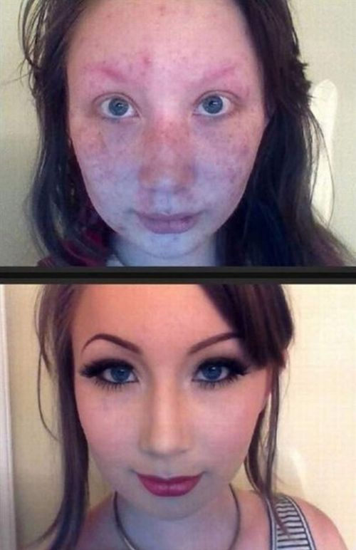 Acid Picdump (116 pics)