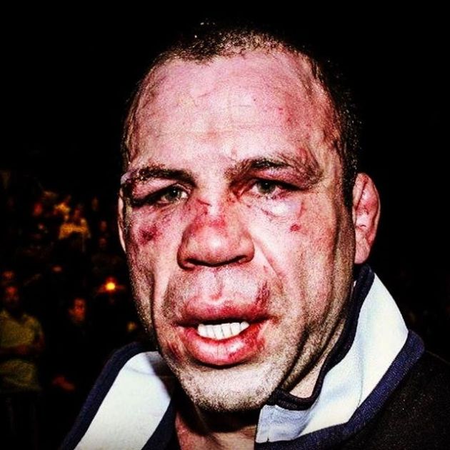 Fascinating Photos That Prove Only The Strong Survive In The World Of Sports (13 pics)