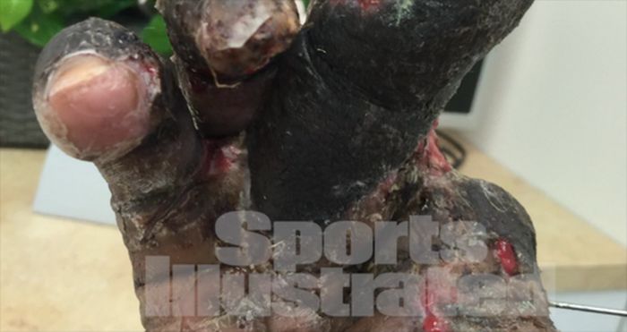 Fascinating Photos That Prove Only The Strong Survive In The World Of Sports (13 pics)