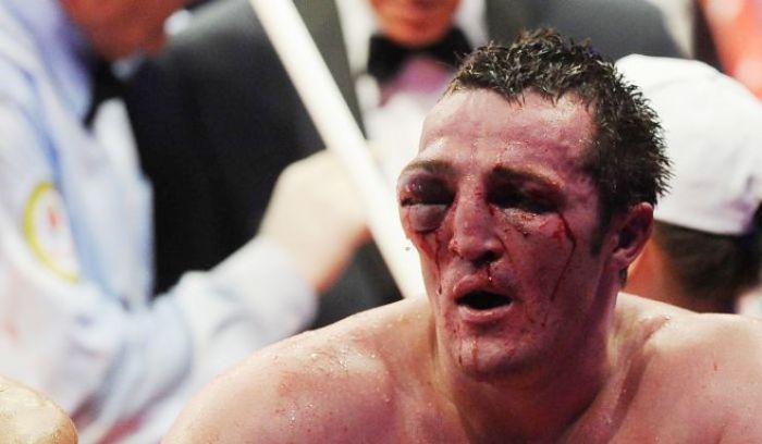 Fascinating Photos That Prove Only The Strong Survive In The World Of Sports (13 pics)