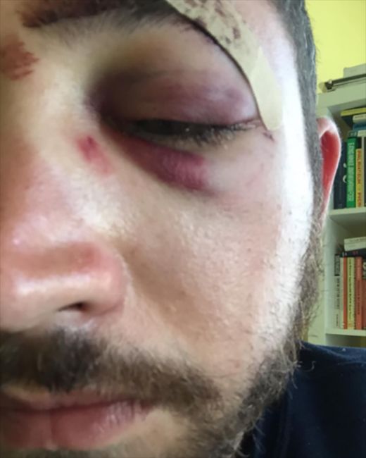 Shia LeBeouf Reaches Out To His Doppelganger Who Got Punched In The Face (4 pics)