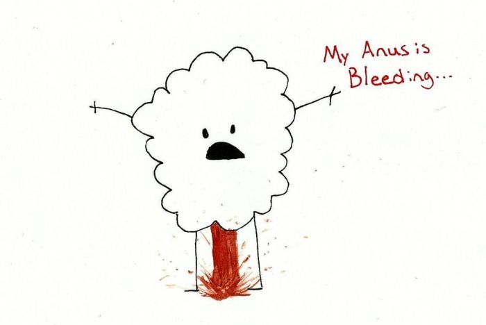 15 Horror Stories That Will Make You Think Twice About Saying Yes To Butt Stuff (15 pics)