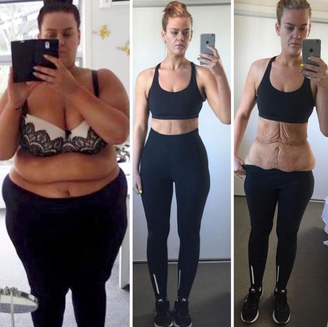 Inspirational Pictures Of People Showing What Dedication And Willpower Can Do (35 pics)
