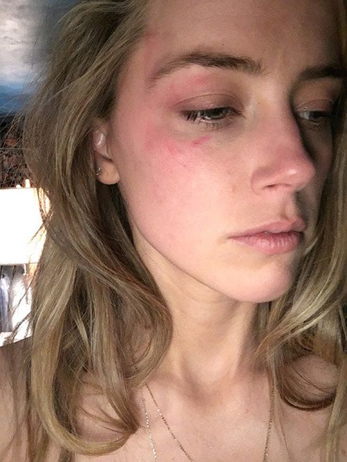 Amber Heard Is Divorcing Johnny Depp And She's Accusing Him Of Being Abusive (4 pics)