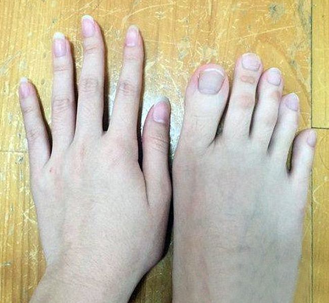 Can You Tell Which Ones Are Fingers And Which Ones Are Toes? (5 pics)