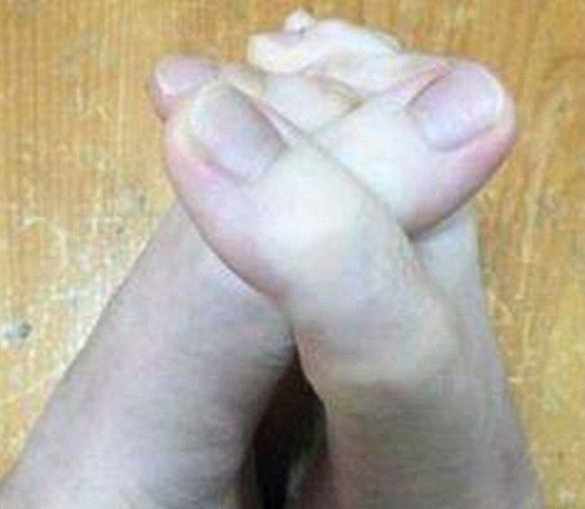 Can You Tell Which Ones Are Fingers And Which Ones Are Toes? (5 pics)
