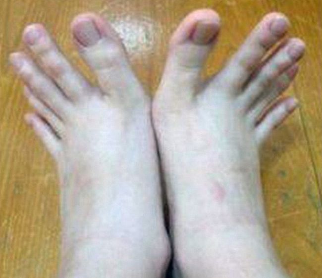 Can You Tell Which Ones Are Fingers And Which Ones Are Toes? (5 pics)