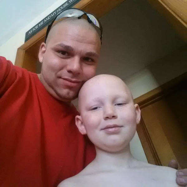 Loving Father Gets Tattoo On His Head To Match His Son's Scar (6 pics)