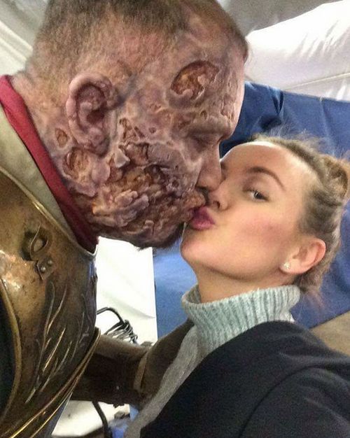 What The Mountain From Game Of Thrones Looks Like With No Helmet On (2 pics)