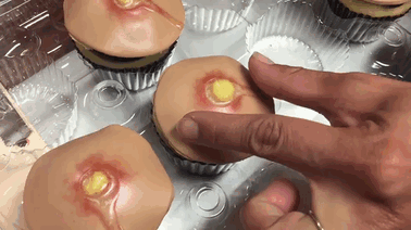 Now You Can Get Pimple Cupcakes With Squeezable Heads (5 pics)