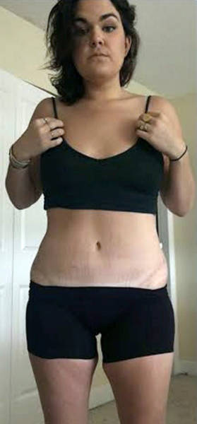 Fast Food Addict Drops Major Weight After Making A Big Change (26 pics)