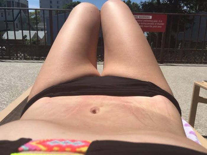 Fast Food Addict Drops Major Weight After Making A Big Change (26 pics)