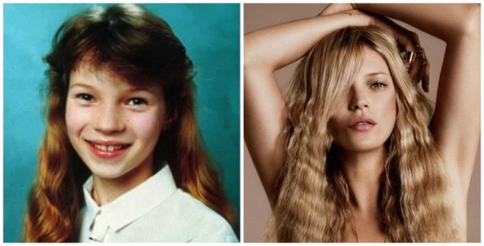 15 Photos Of Celebrities Who Used To Look Like Total Nerds (15 pics)