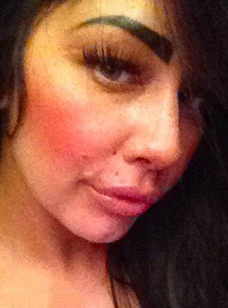 This Woman Wants To Take Her Huge Lips And Make Them Even Bigger (11 pics)