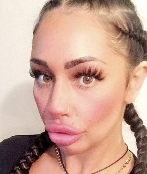 This Woman Wants To Take Her Huge Lips And Make Them Even -6823