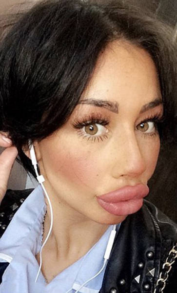 This Woman Wants To Take Her Huge Lips And Make Them Even Bigger (11 pics)