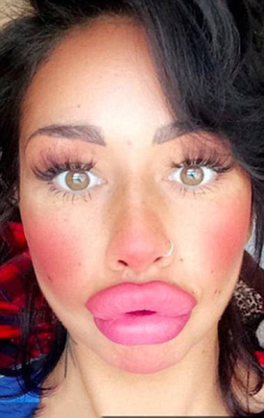 This Woman Wants To Take Her Huge Lips And Make Them Even Bigger 11 Pics