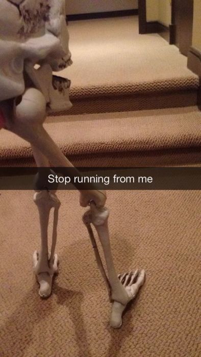 This Guy's Sad Story About His Skull Became A Snapchat Sensation (8 pics)