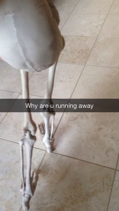 This Guy's Sad Story About His Skull Became A Snapchat Sensation (8 pics)